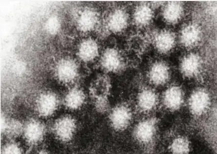 Norovirus