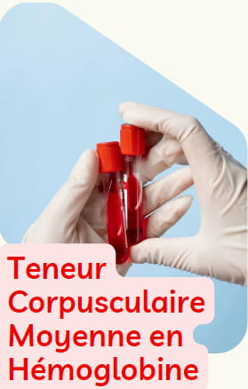 TCMH Test