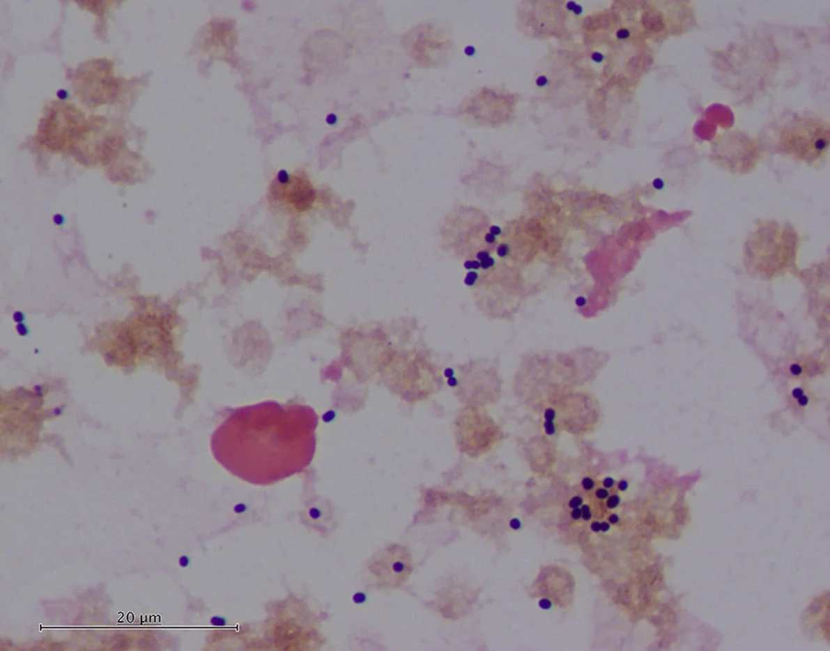 Coloration de Gram et Acinetobacter