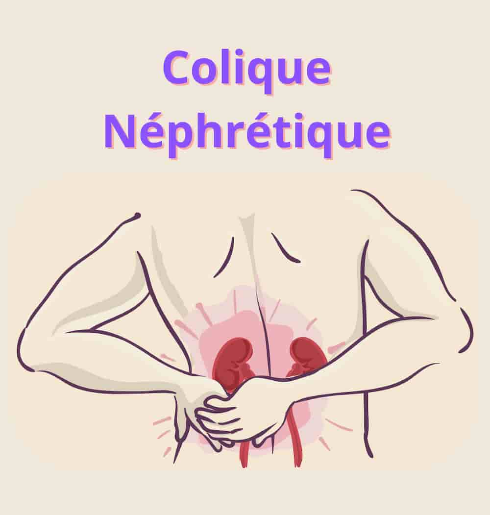 colique néphrétique