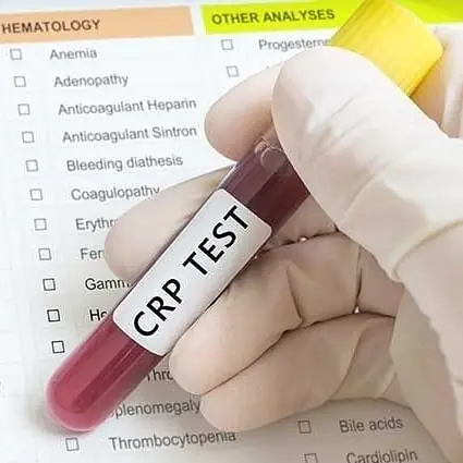 lab-tests