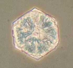 cristaux de cystine