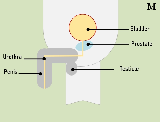 cystitis