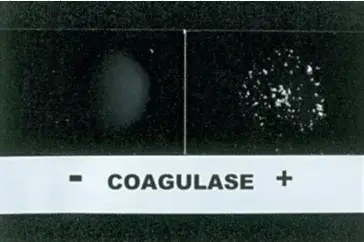 Bound coagulase (clumping factor) 