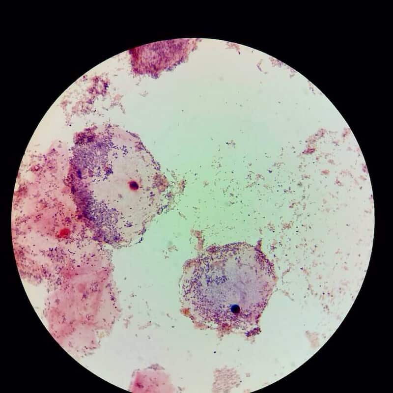 examen-microscopique clue cells