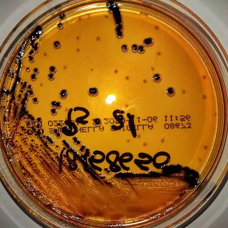 Salmonella Shigella Agar