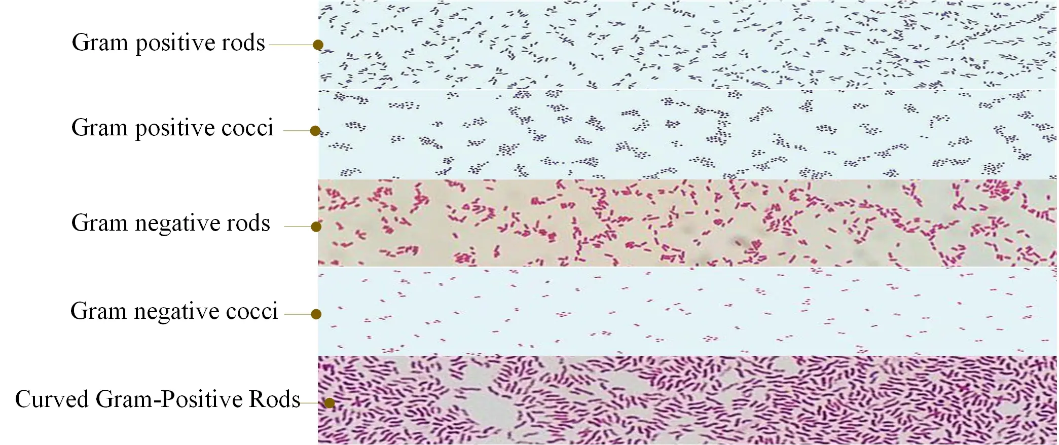 Gram stain