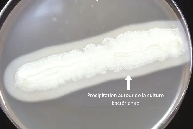 Résultat lécithinase