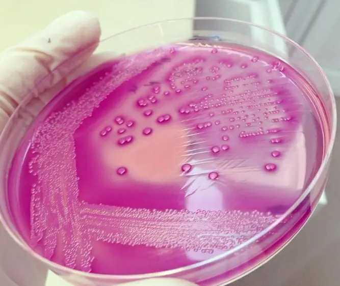 Escherichia coli sur gélose MacConkey