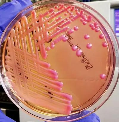 Klebsiella sur MacConkey