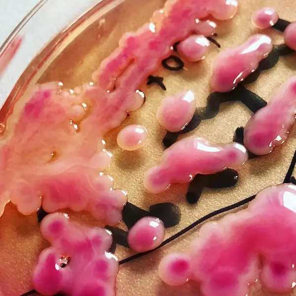 Klebsiella sur gélose MacConkey