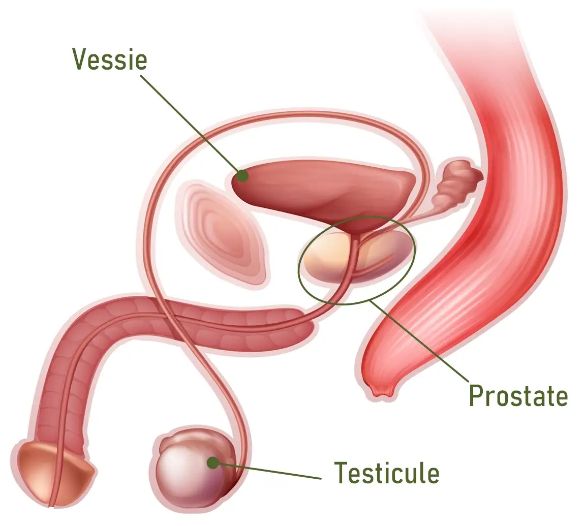 prostatite