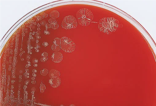 pseudomonas-stutzeri