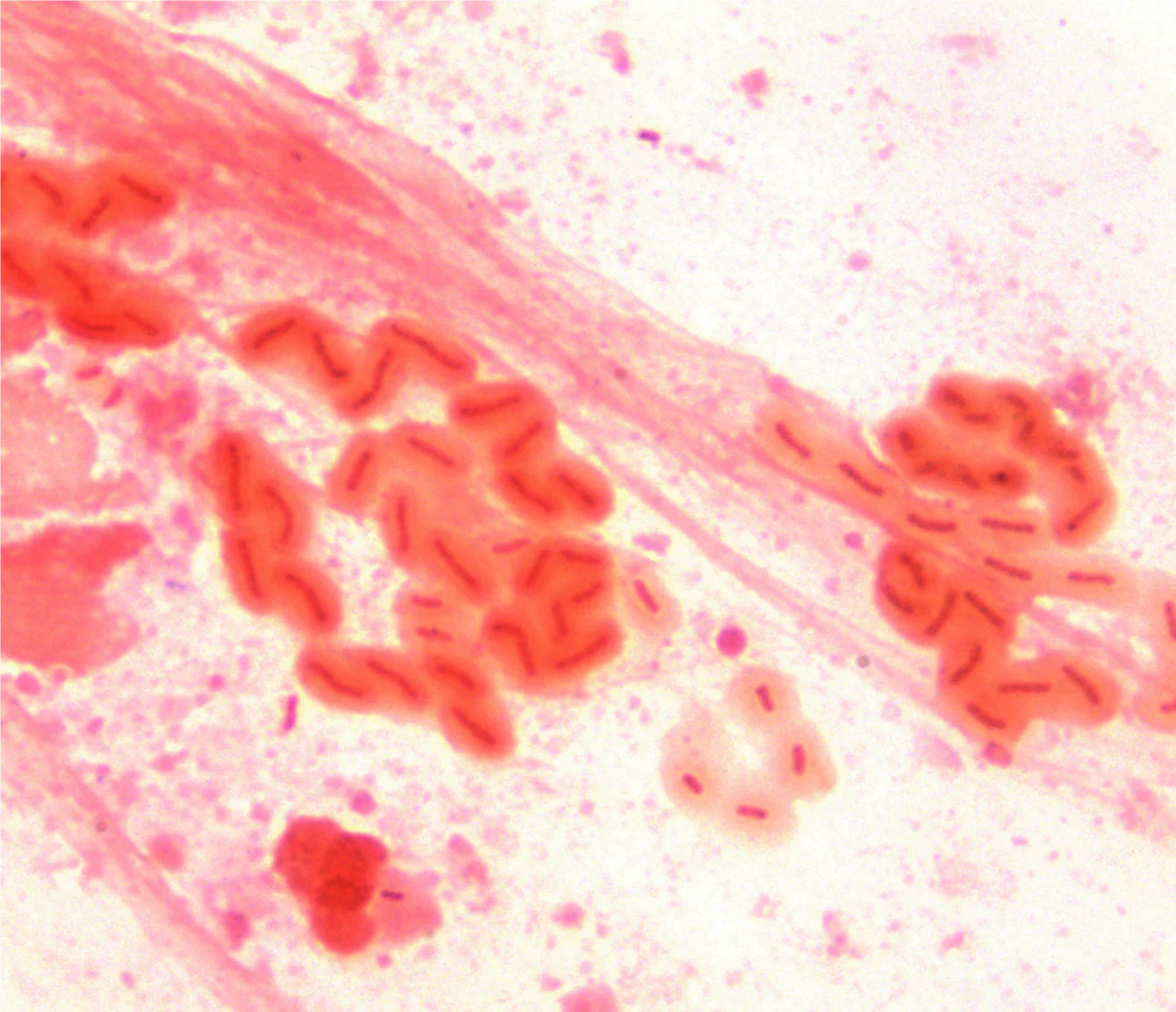 pseudomonas mucoid strain 