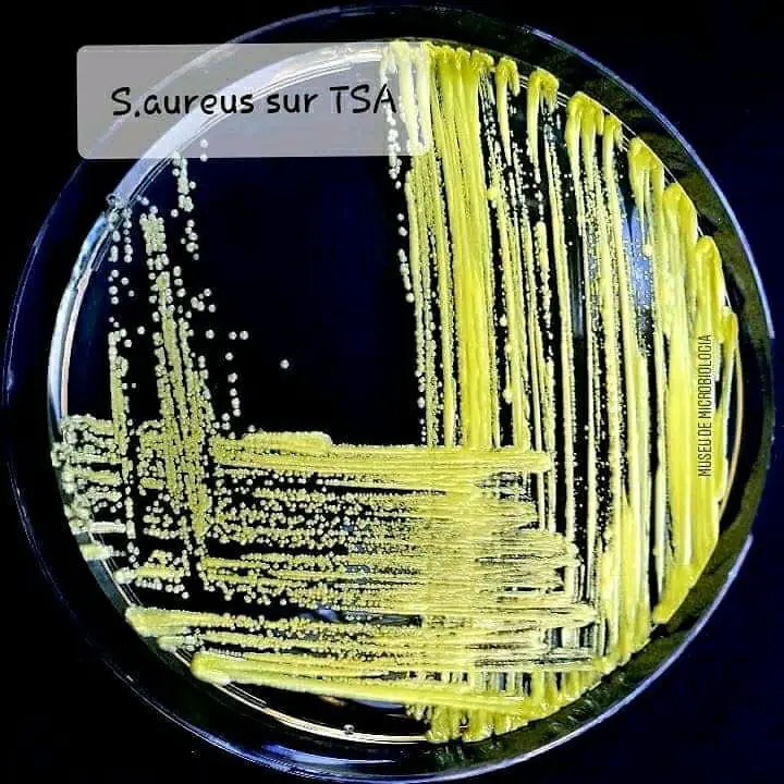 Gélose trypticase soja